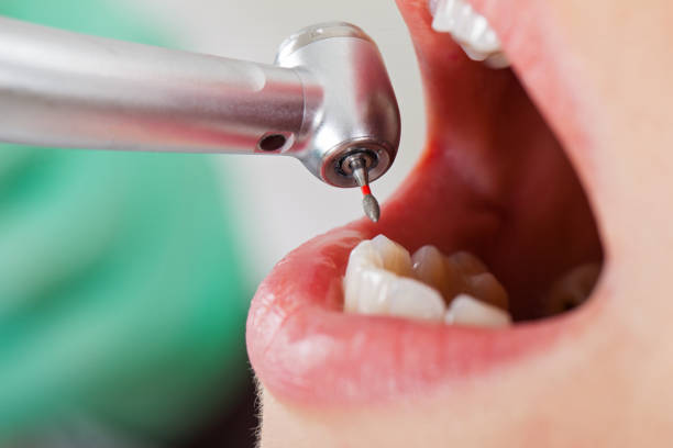 Best Broken Tooth Emergency  in Tuckerman, AR